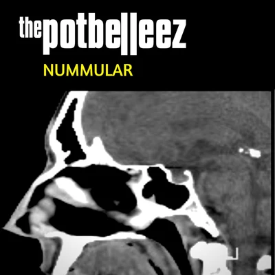 Nummular 專輯 The Potbelleez