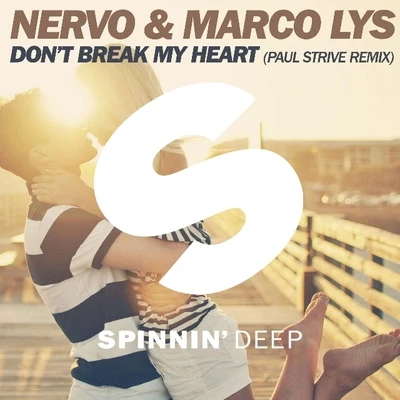 Dont Break My Heart (Paul Strive Remix) 專輯 Nervo/R3hab/Ummet Ozcan