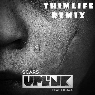 Scars (Thimlife Remix) 專輯 ThimLife