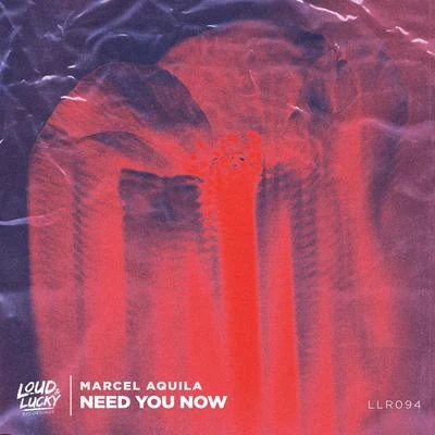 Need You Now 專輯 Robin K./Koslow/Marcel Aquila