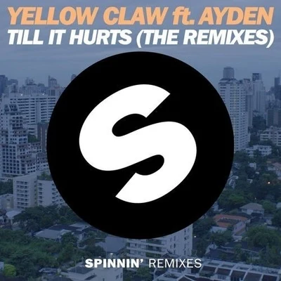 Yellow Claw Till It Hurts (The Remixes)