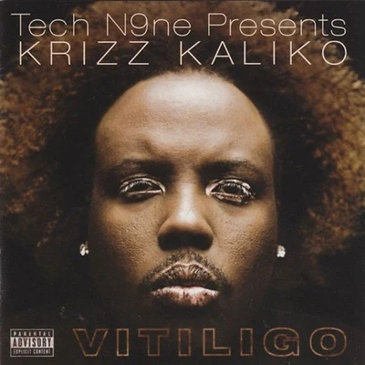 Krizz KalikoBig Scoob Vitiligo